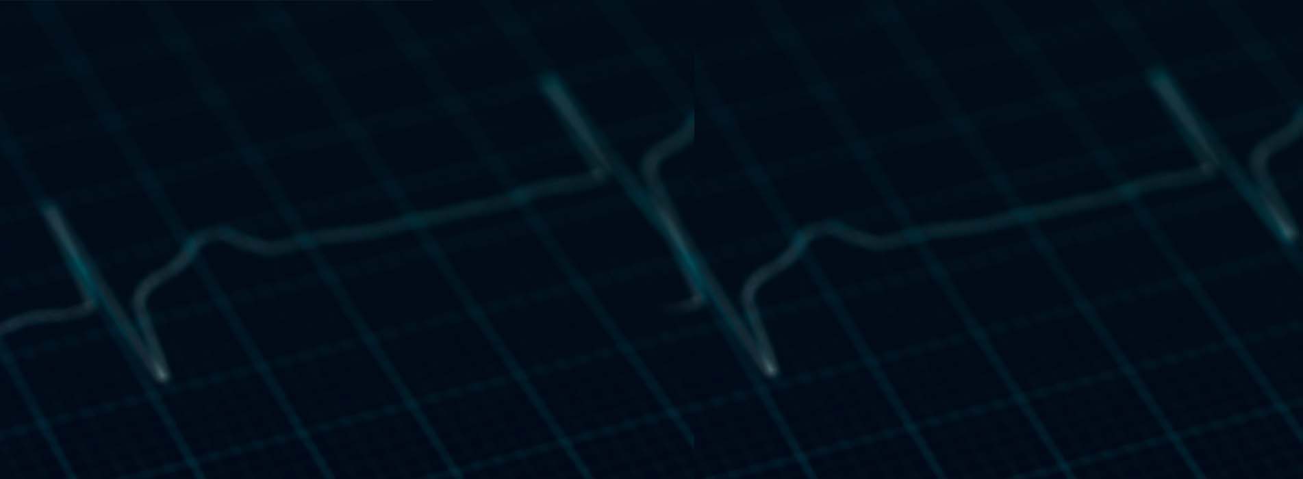 An EKG waveform of a heartbeat pulsating against a dark background